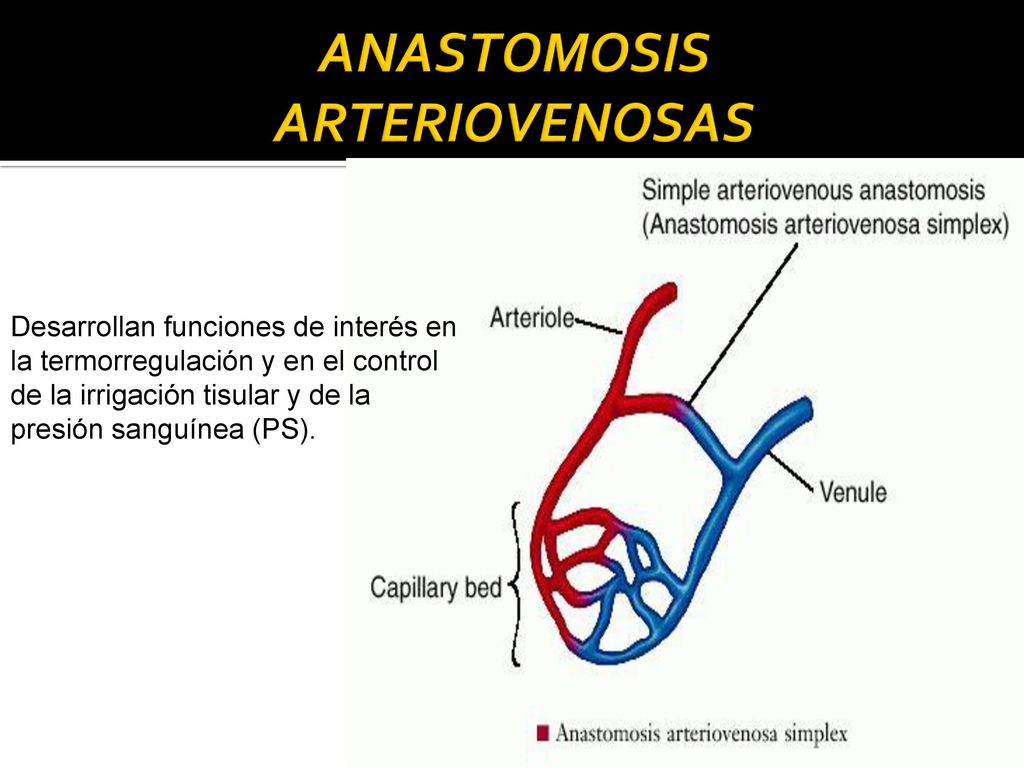 anastomosis arteriovenosa